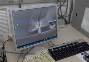 Jeol JSM 7600 F FE-SEM (Field Emission Scanning Electron Microscope)