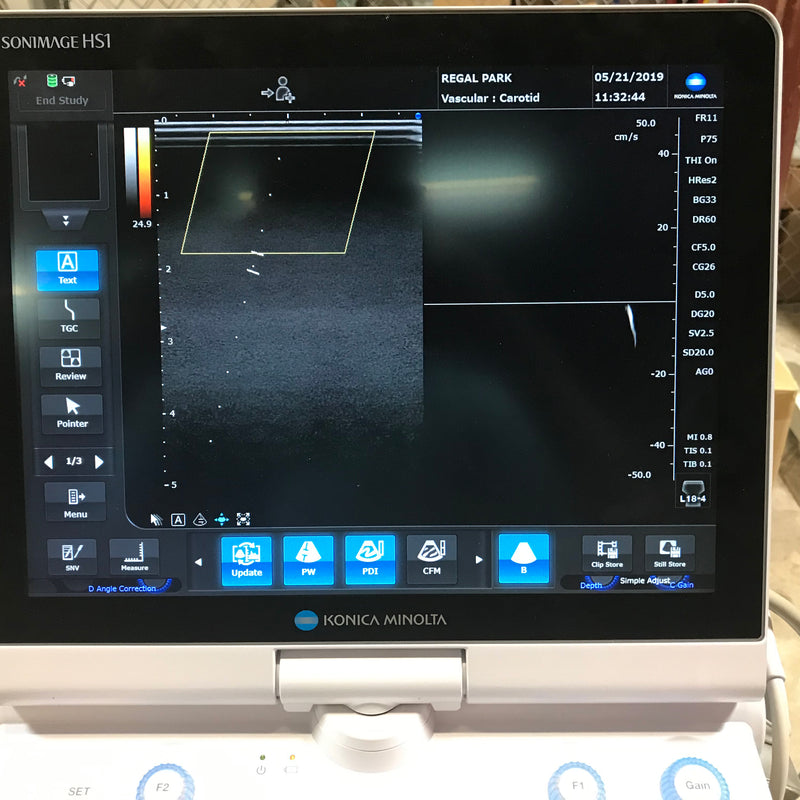 Konica Minolta Sonimage HS 1 Ultrasound System